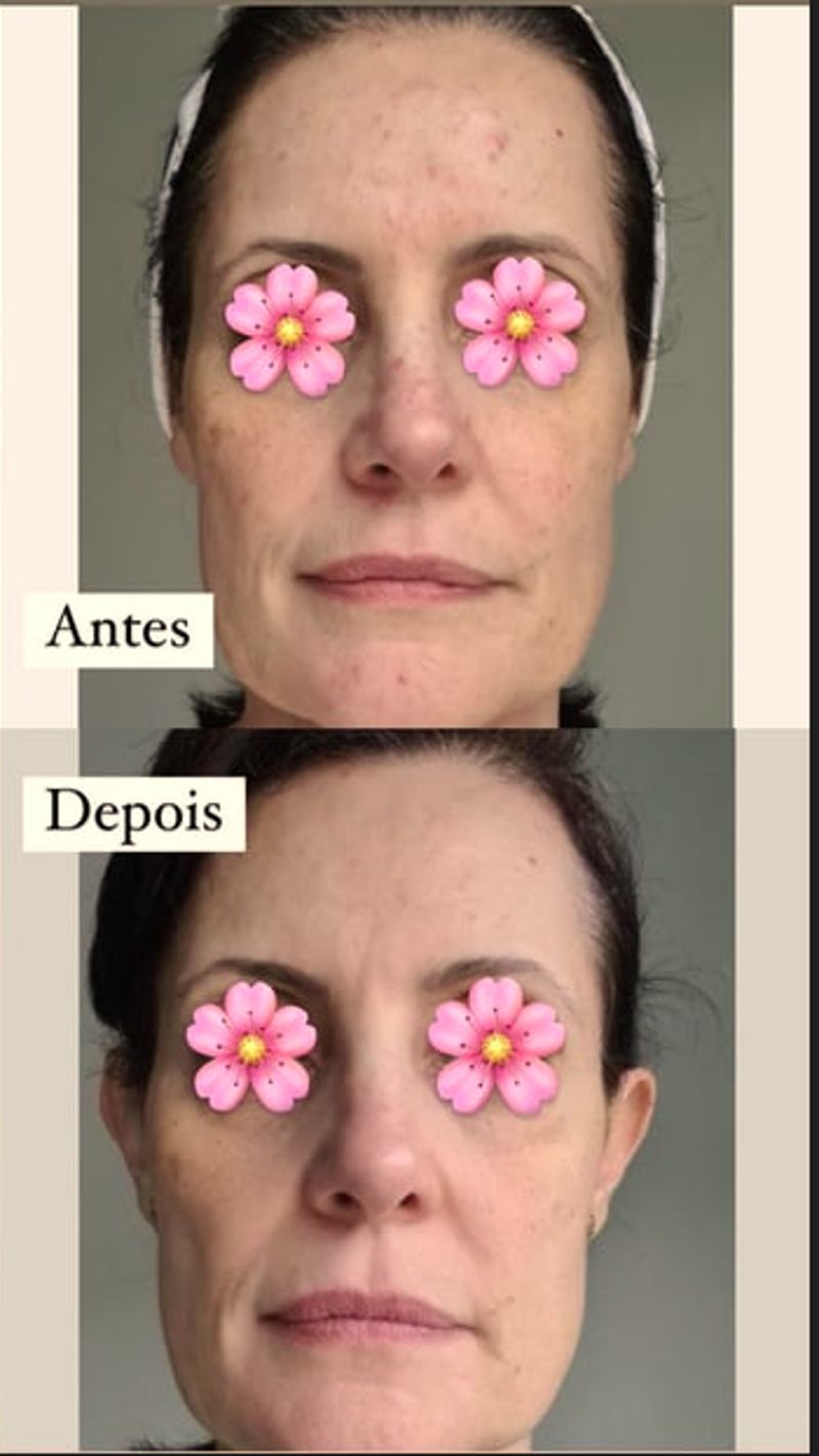 Autoestima restaurada